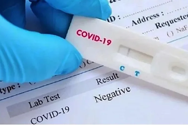 Anmat aprobó el uso del autotest de coronavirus