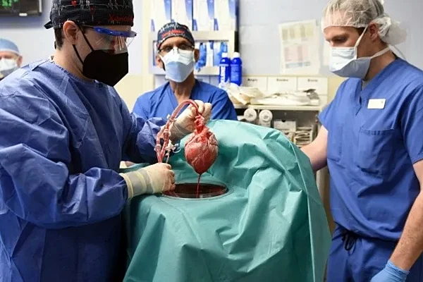 Por primera vez, trasplantaron con éxito un corazón de cerdo a un hombre