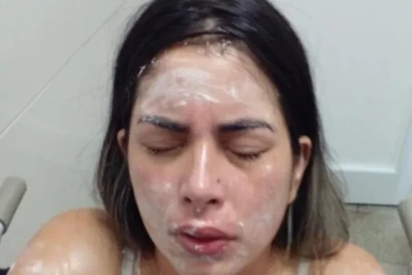 Una mujer roció con gas pimienta a otra porque le habría chocado el auto