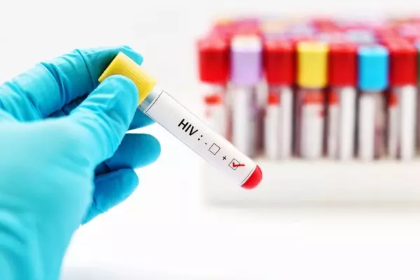 la Cámara de Diputados tratará el proyecto de ley de respuesta integral a la infección por el Virus de Inmunodeficiencia Humana.