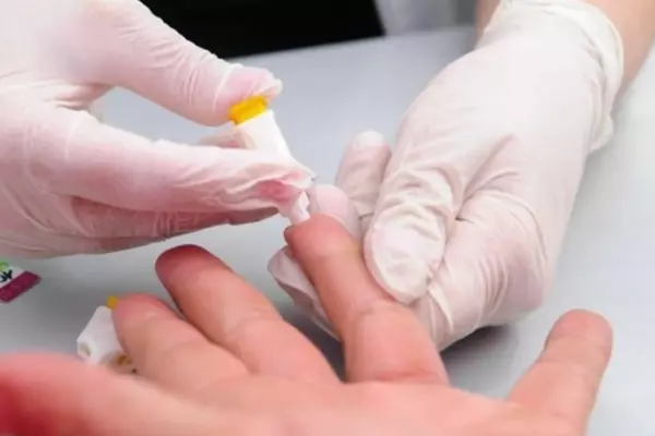 Hepatitis desconocida: según la OPS hasta el 10 de mayo se habían notificado 348 casos probables en 21 países.