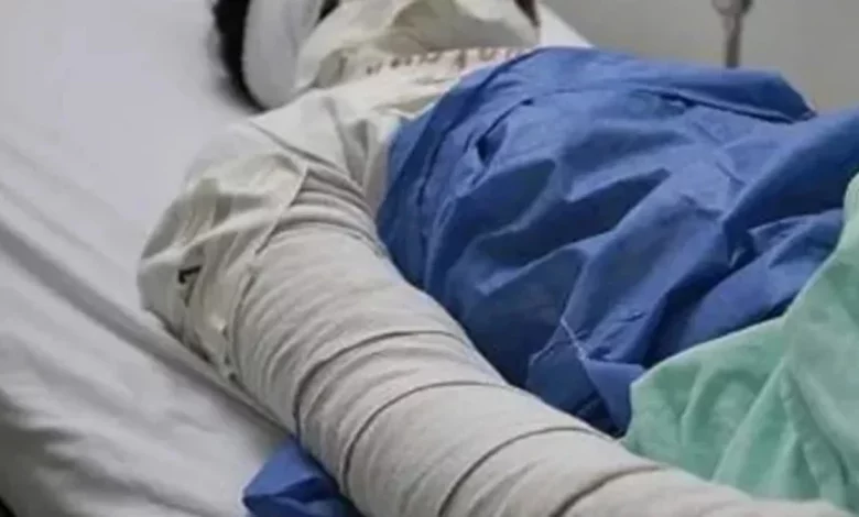 Internaron a una mujer con 80% del cuerpo quemado en un intento de femicidio